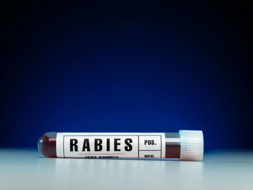 Rabies Neutralising Antibody Titre Test