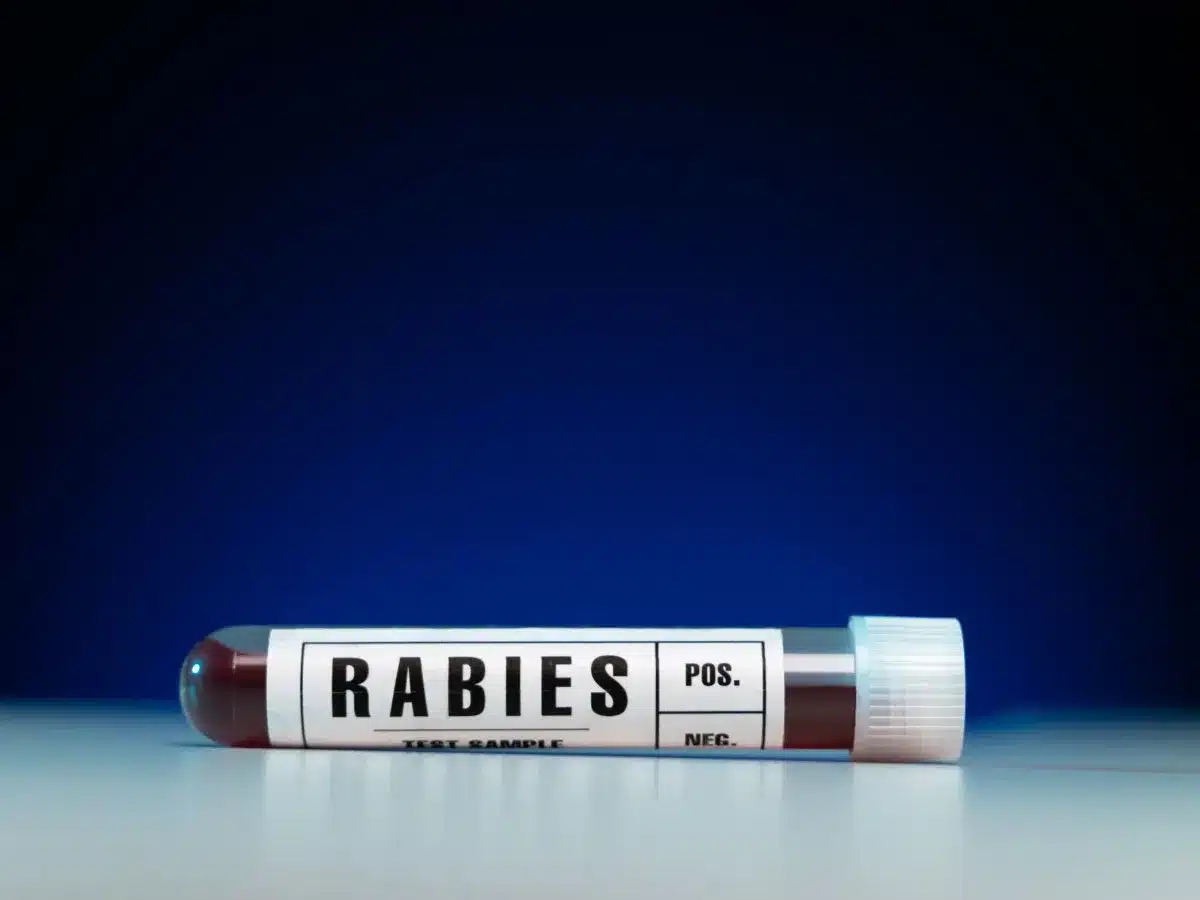 Rabies Titer Test